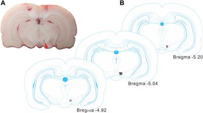 Arecoline Induces an Excitatory Response in Ventral Tegmental Area Dopaminergic Neurons in Anesthetized Rats